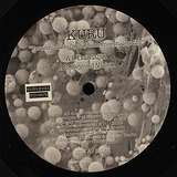 Kuru: Transmissible Spongiform Encephalopathy LP