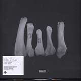 Leiras: These Ancestral Bones